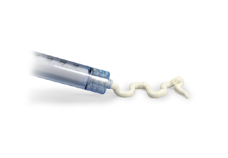 Subchondroplasty® (SCP®) thumbnail 2